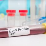 Lipid Profile Test