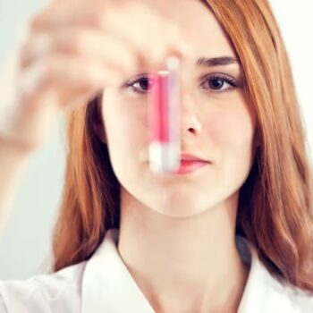 Progesterone, Serum Test