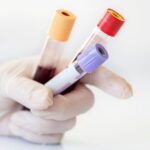 Lipid Profile Test (3)