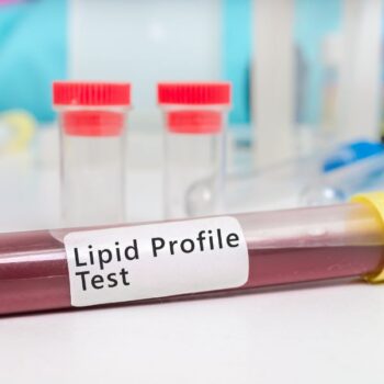 Lipid Profile Test