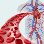 Anemia Profile- A