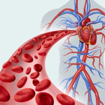 Anemia Profile- A