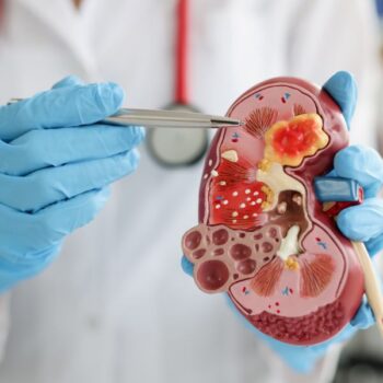 Kidney Function Test ( MINI )