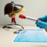 Liver Function Test (LFT)