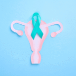 CA-125 Ovarian Cancer Marker