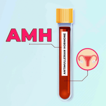 Anti Mullerian Hormone (AMH)
