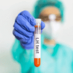 Lutenising Hormone (LH)
