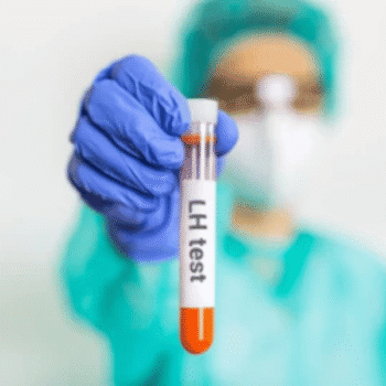 Lutenising Hormone (LH)