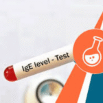 Immunoglobulin - IgE