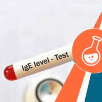 Immunoglobulin - IgE