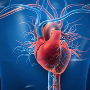 Troponin -I Quantitative