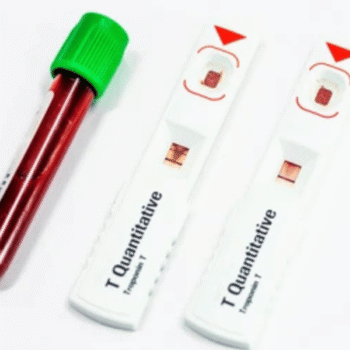 Troponin - T quantitative