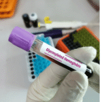 Glycosylated haemoglobin - HbA1C
