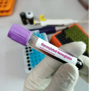 Glycosylated haemoglobin - HbA1C