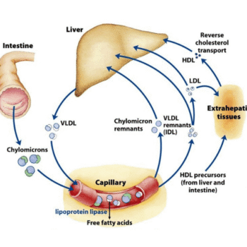 Advanced Lipid Profile