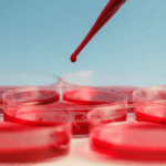Coombs Test Direct(DCT)