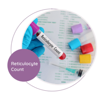 Reticulocyte Count