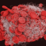 Total Leucocyte Count(TLC)