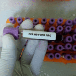 HCV Quantitative