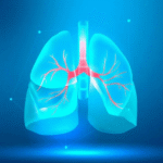 Genexpert for TB