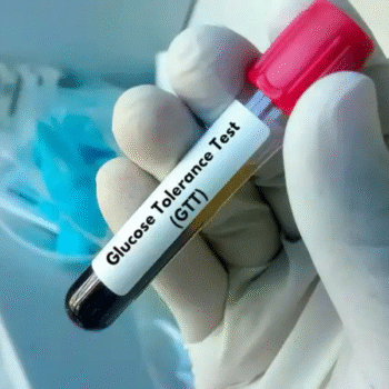 Glucose Tolerance Test (GTT)