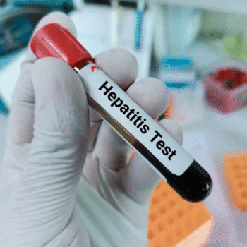 Hepatitis Screening Tests