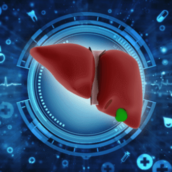 Gamma GT (GGT) – Liver Enzyme Test