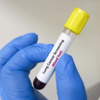 Lung Cancer Marker Panel