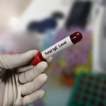 Specific IgE Allergy Panel (Individual Allergen Tests)