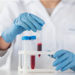 Drug & Chemical Allergy Panel