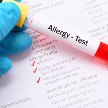 Comprehensive Allergy Profile