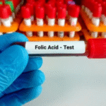 Folic Acid (Vitamin B9)