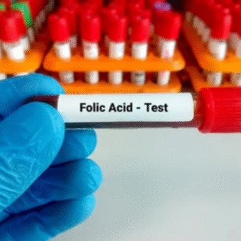 Folic Acid (Vitamin B9)