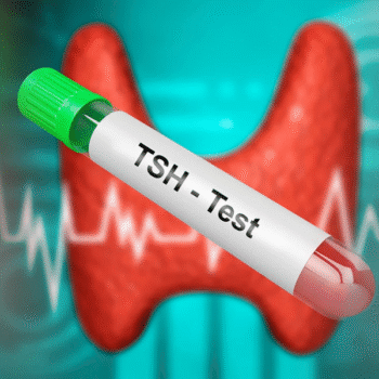 Total Thyroid Profile (T3, T4 & TSH)