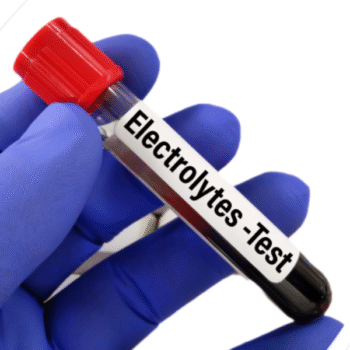 Electrolyte Profile