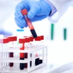 Inflammatory Marker Profile