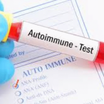 Autoimmune Screening Panel