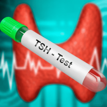 TSH Receptor Antibody (TRAb)